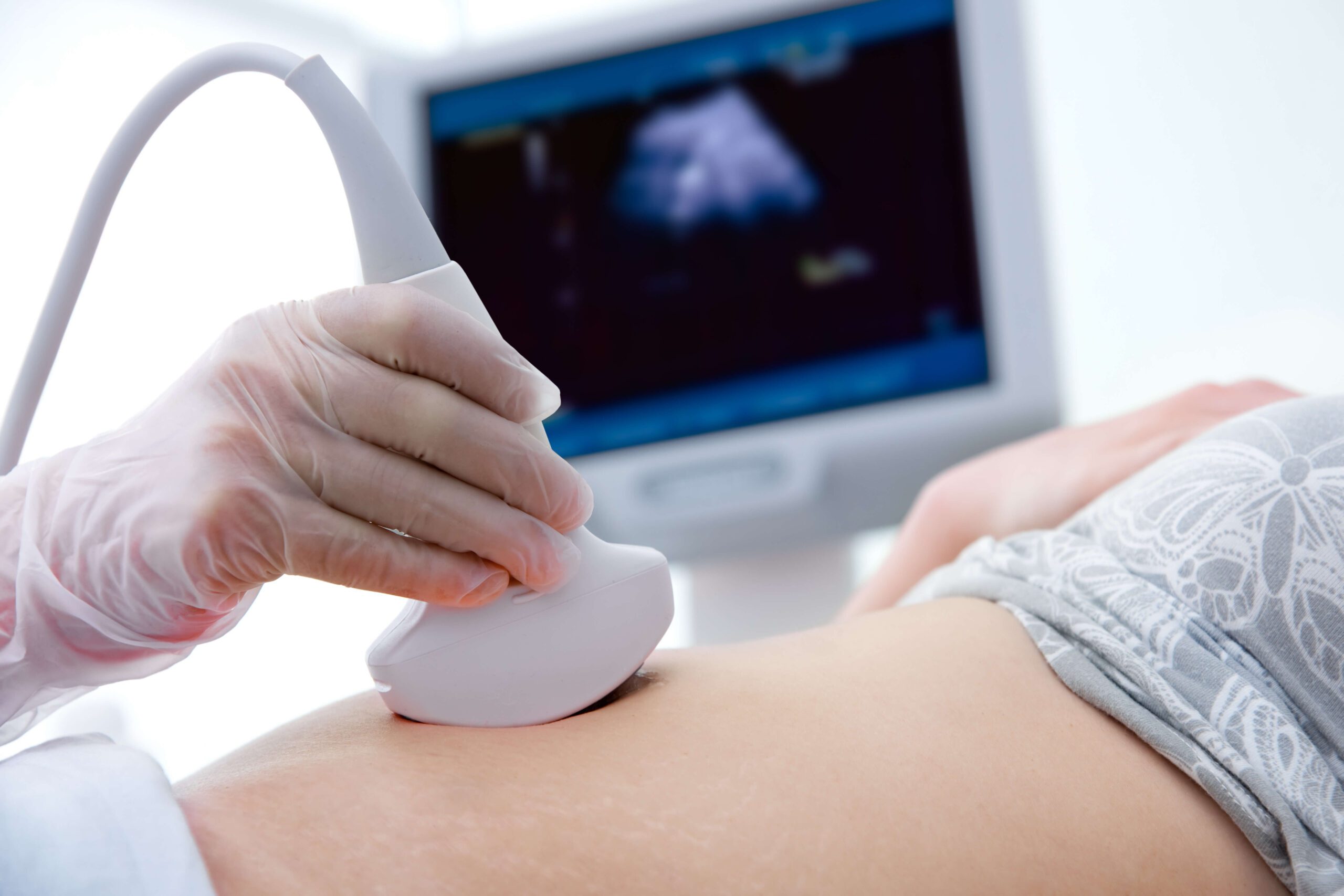 female patient receiving ultrasound scaled 1